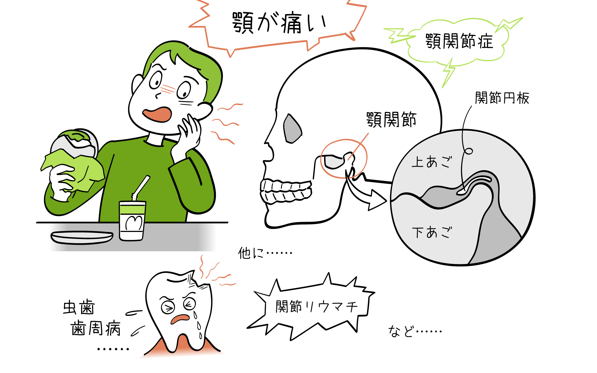 顎関節症の症状診断治療を、こころみクリニックの耳鼻科専門医が解説。
