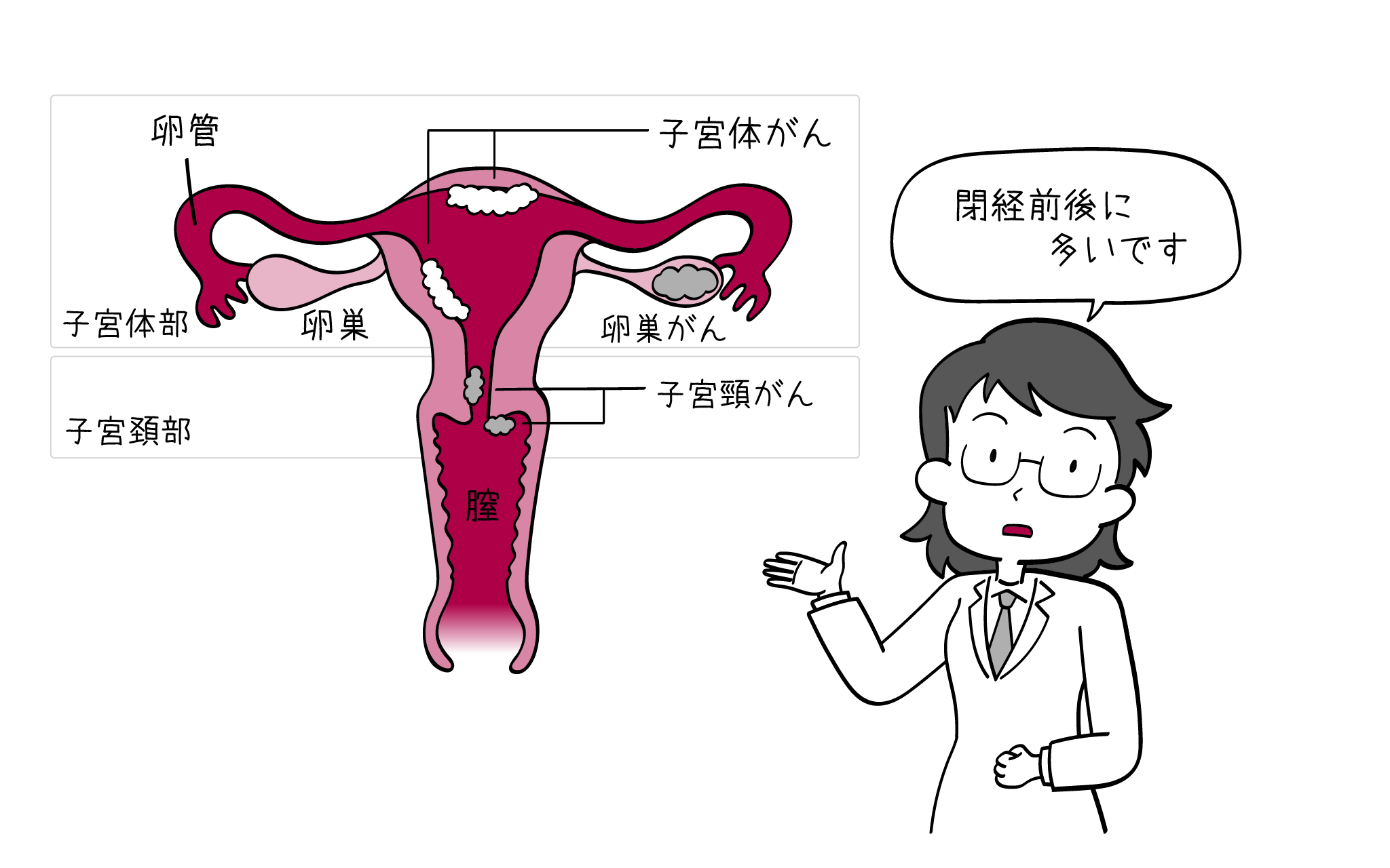 子宮がんについて、元住吉院の婦人科専門医が解説。