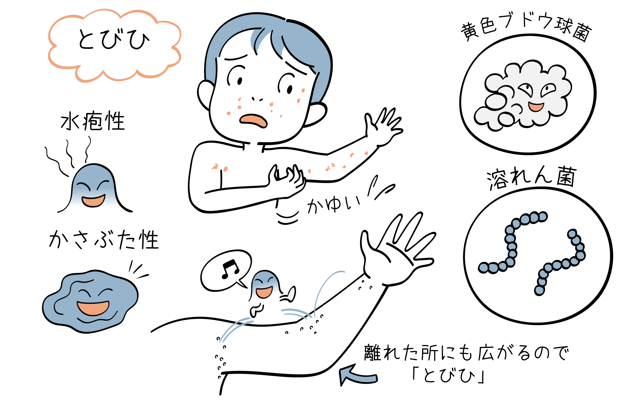 とびひについて、こころみクリニックの小児科専門医が解説します。