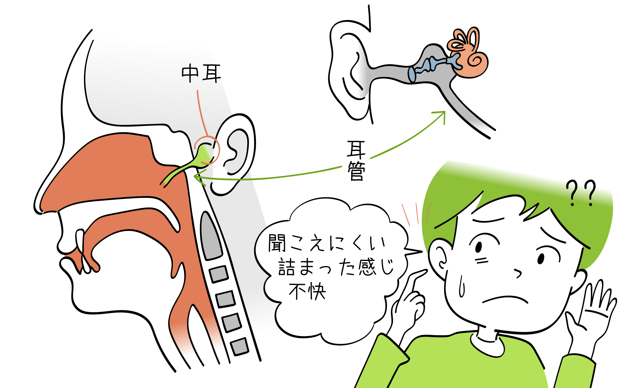 耳管狭窄症について、こころみクリニック耳鼻科専門医が解説。