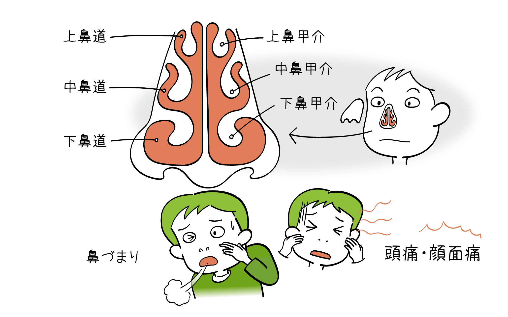 鼻甲介肥大について、元住吉院の耳鼻科専門医が解説します。
