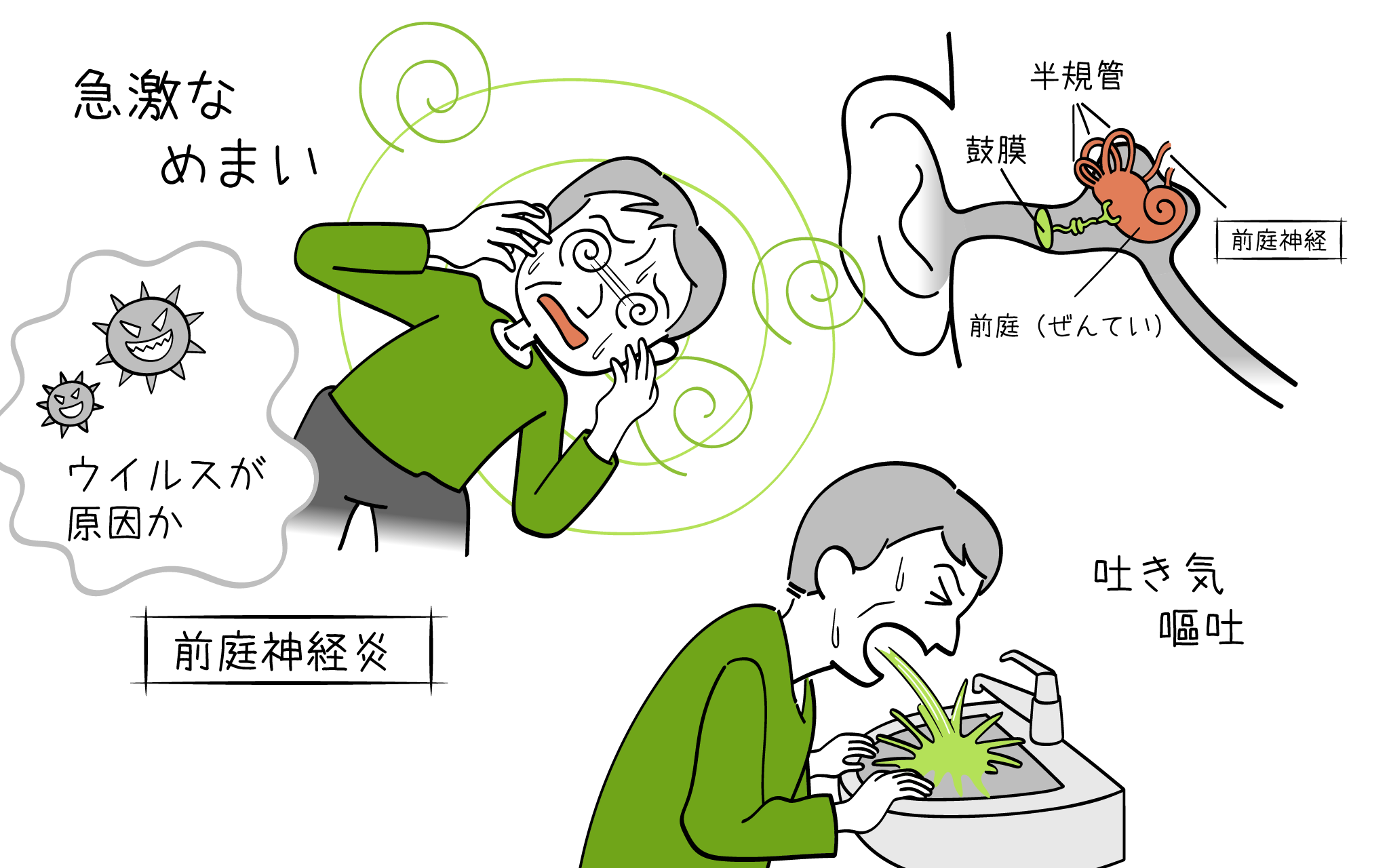 前庭神経炎について、こころみクリニックの耳鼻科専門医が解説