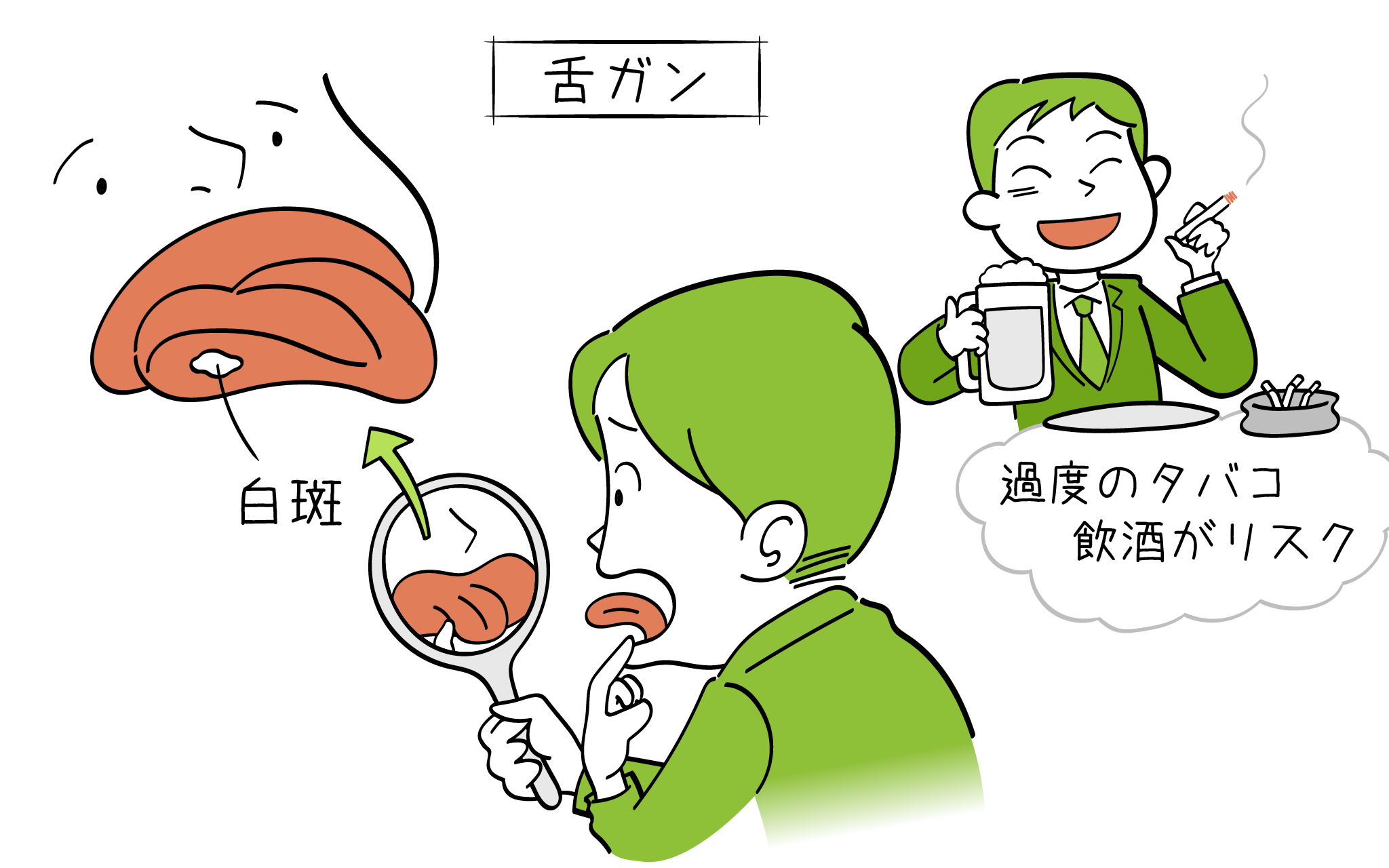 舌癌の症状、診断、治療について、こころみクリニックの耳鼻科専門医が解説。
