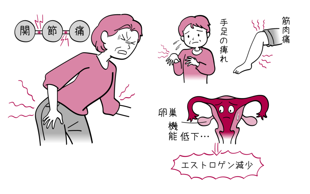 更年期と関節痛について、婦人科専門医がまとめています。