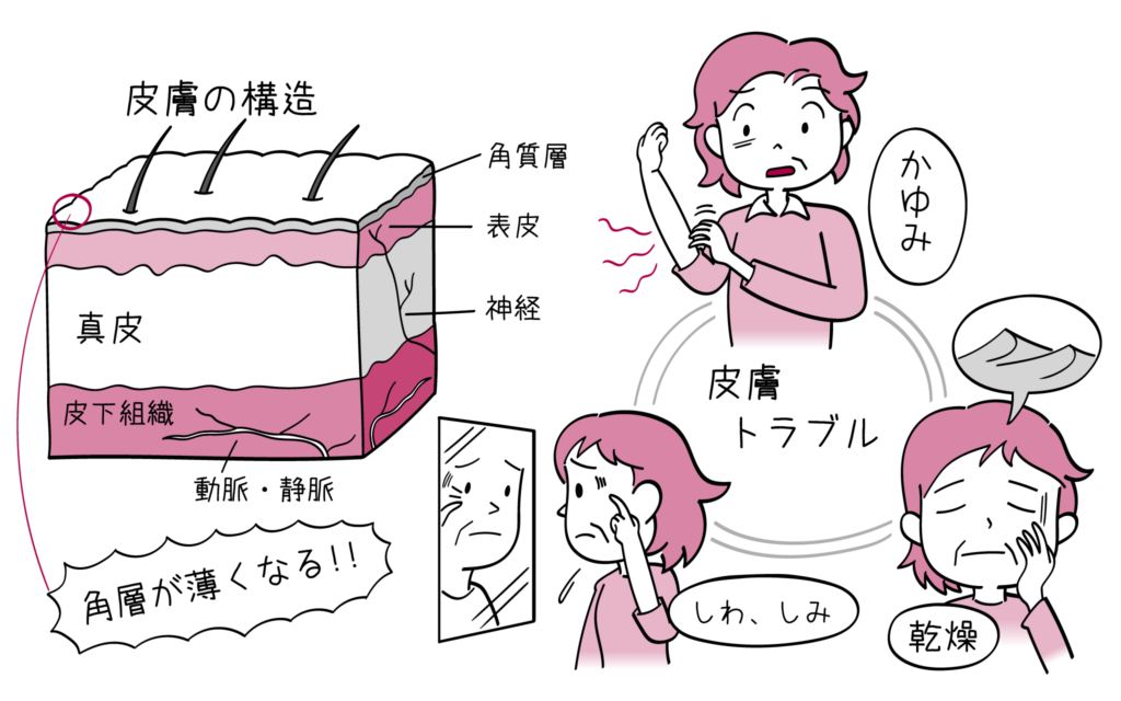 更年期障害での皮膚トラブルについて、婦人科専門医が解説します。