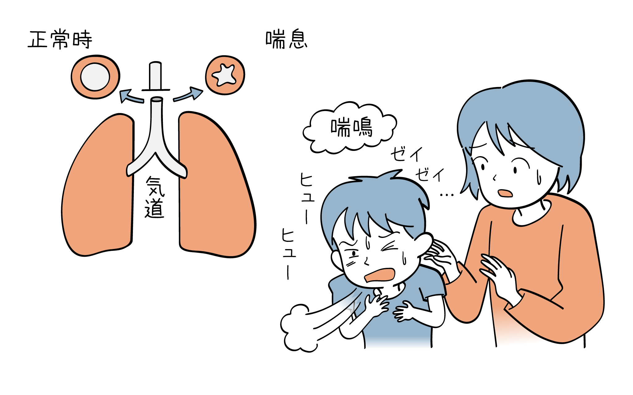 子供の喘鳴について、こころみクリニックの小児科専門医が詳しく解説します。