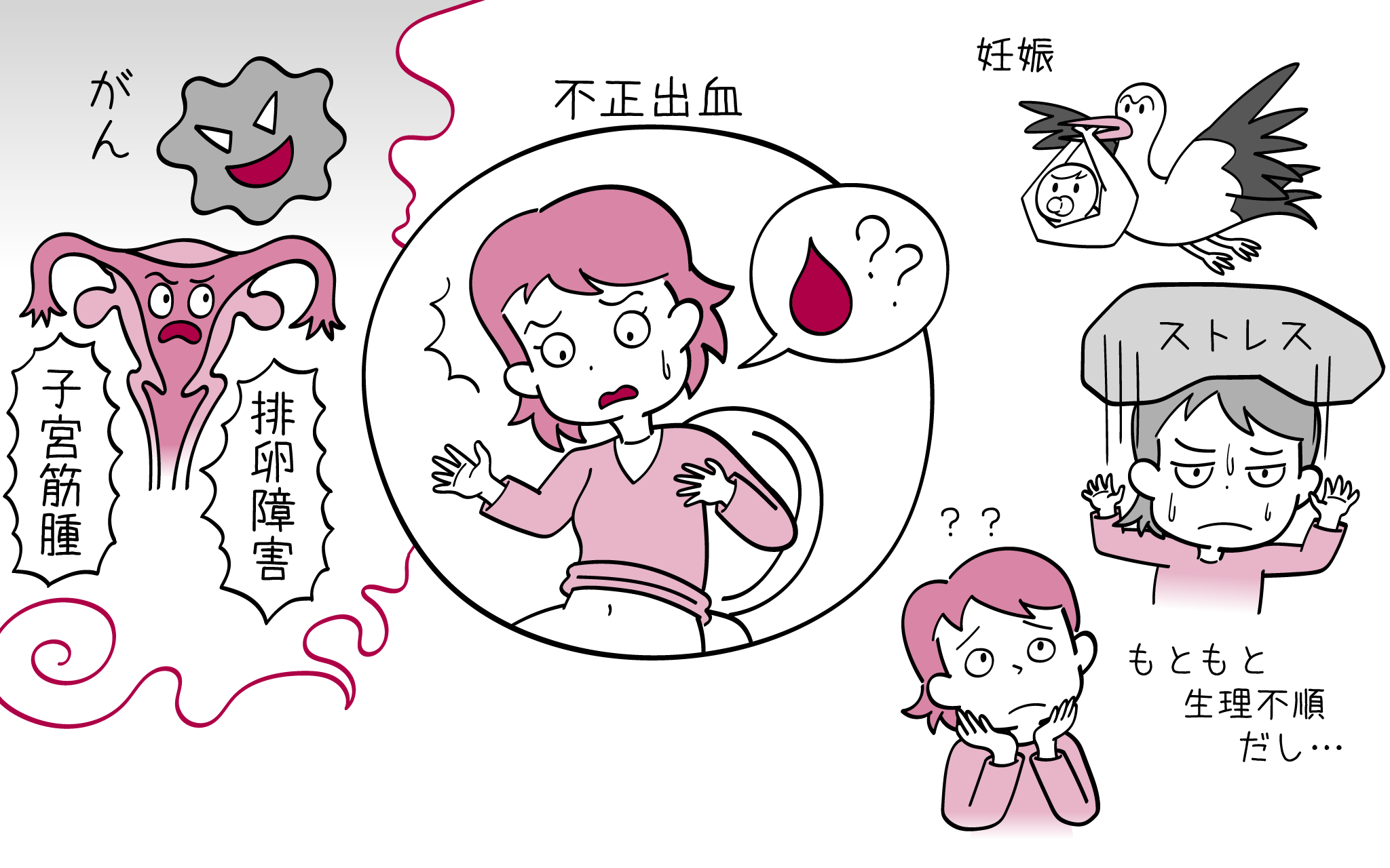 不正出血について、産婦人科専門医が詳しく解説。
