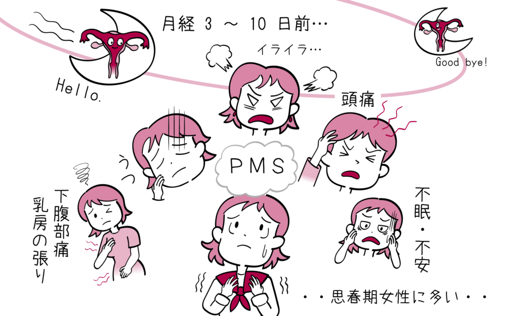 月経前症候群（PMS）について、婦人科専門医が解説します。