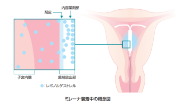 子宮