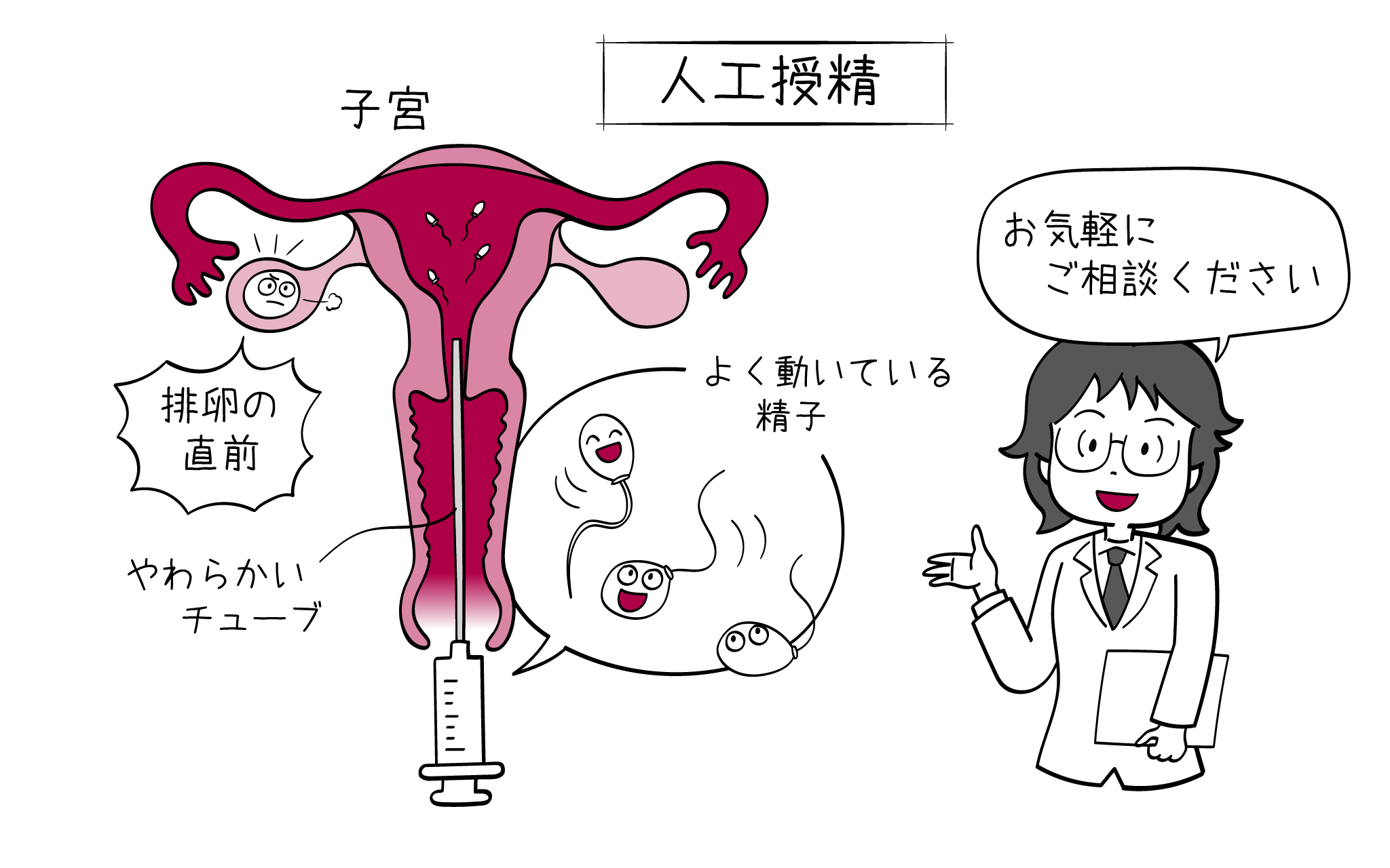 人工授精について、婦人科専門医が解説します。