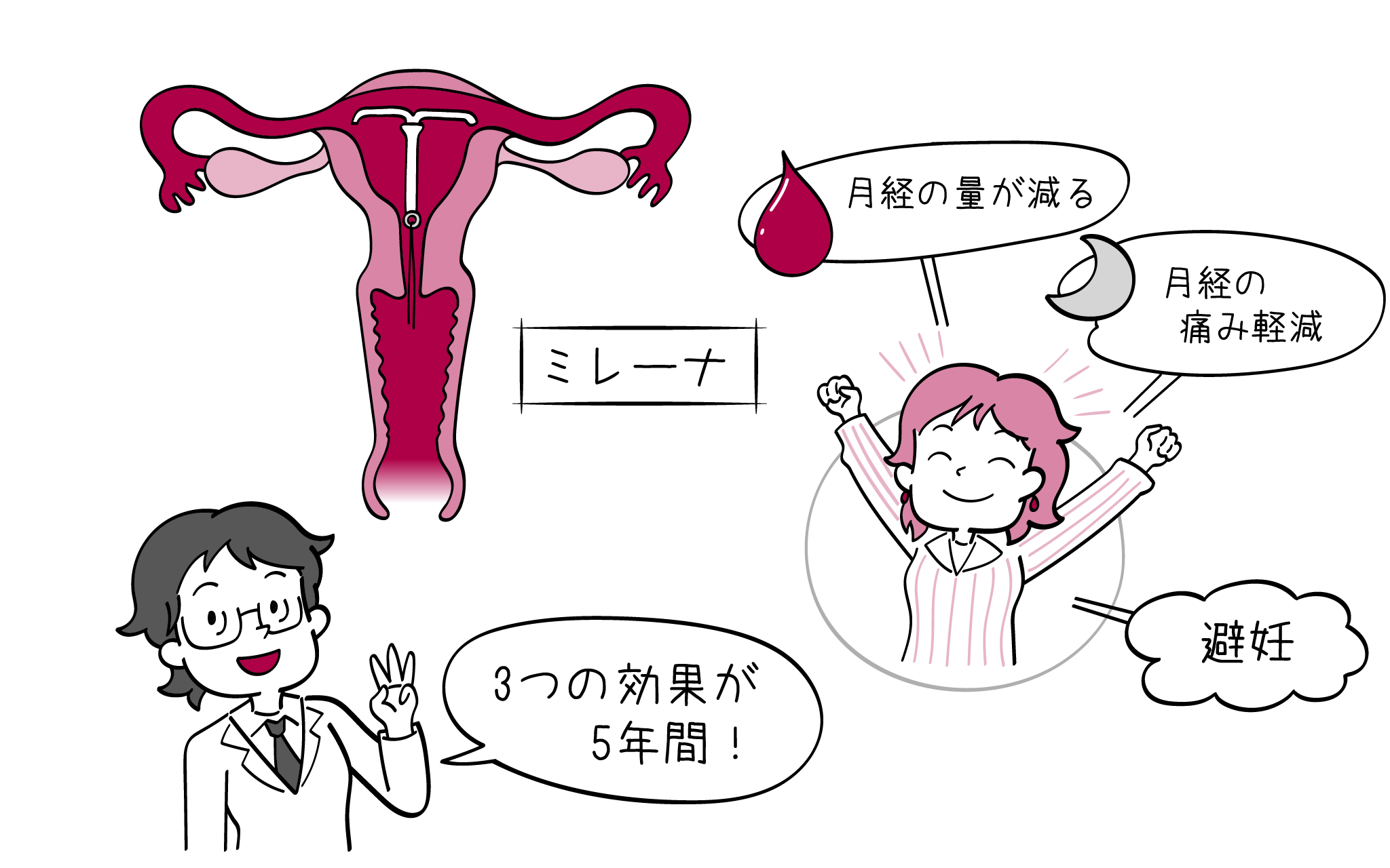 ミレーナについて、婦人科専門医が解説します。