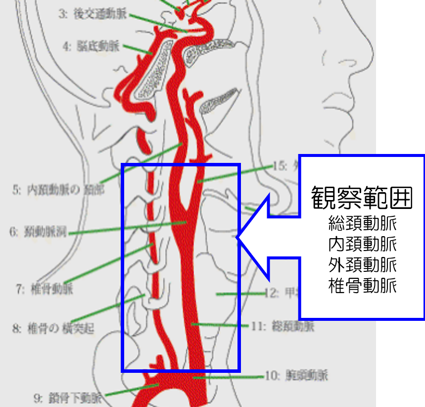頸動脈エコーで見れる範囲をイラストで示します。