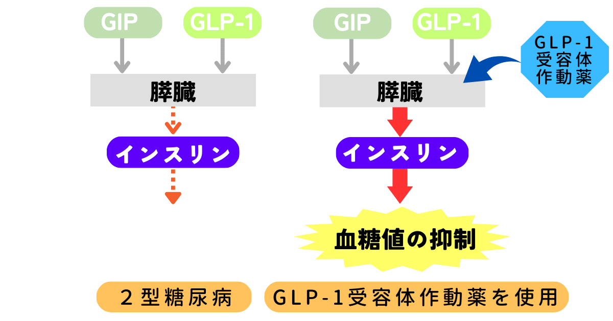 GLP-1阻害薬のメカニズムを医師が図表で説明します。