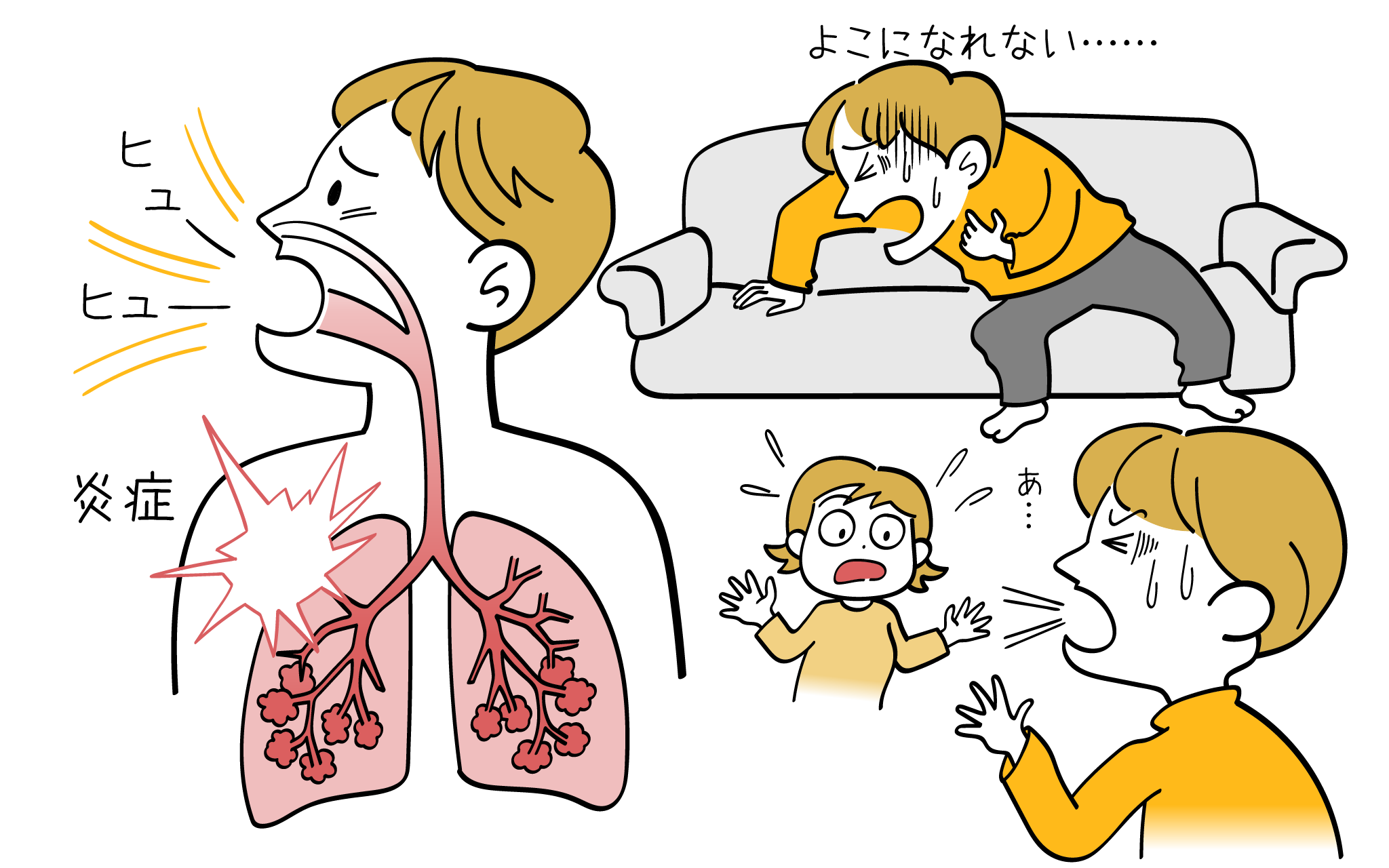 気管支喘息の症状について、内科専門医が詳しく解説します。