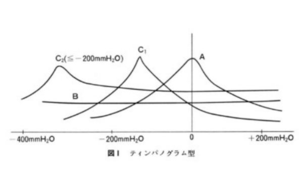 ティンパノグラム型のグラフ