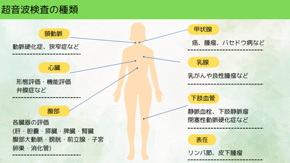 超音波の種類についてまとめたイラストになります。