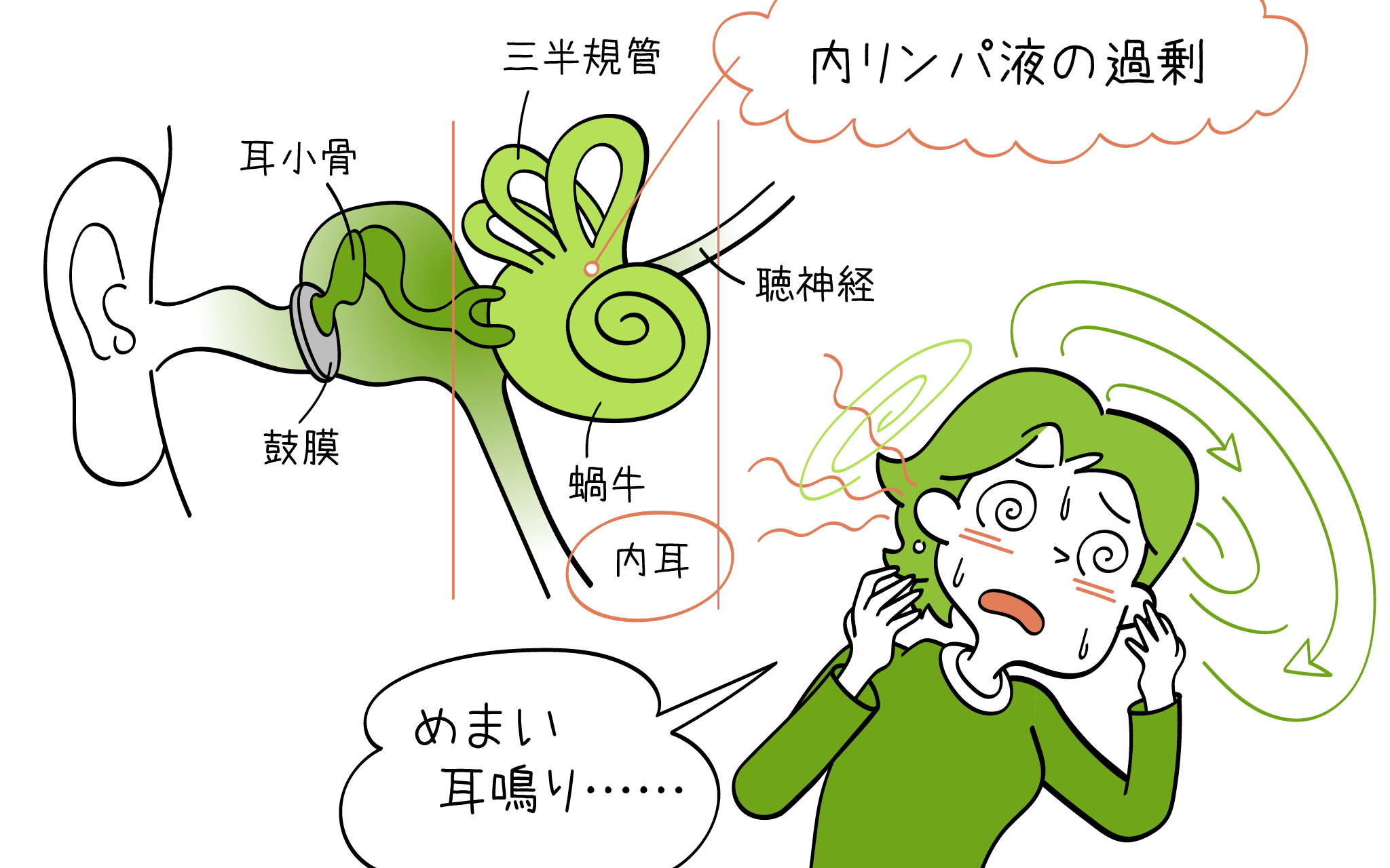 メニエール病の症状・診断・治療について元住吉駅前院の医師が解説