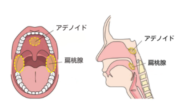 アデノイドの位置