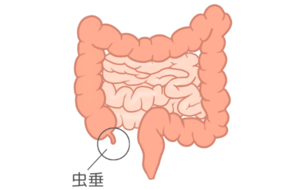 虫垂の画像